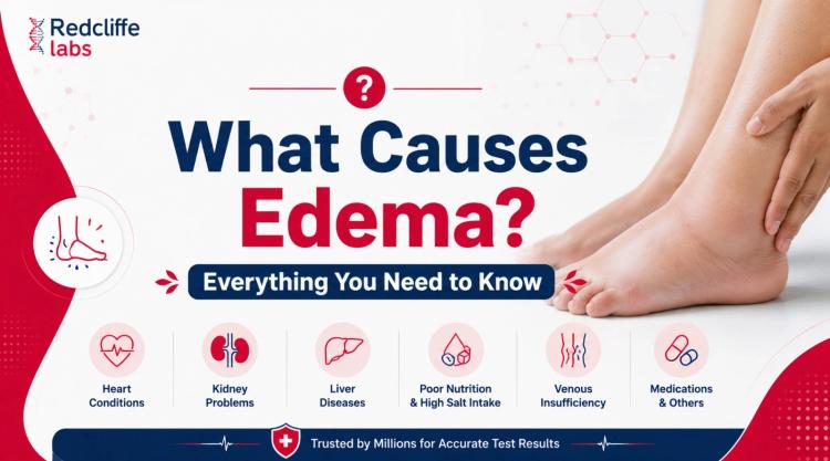 What Causes Edema? Everything You Need to Know