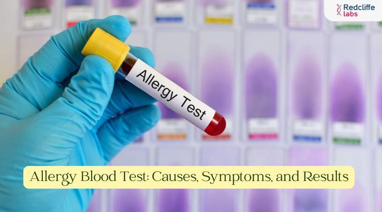 Allergy Blood Test: Causes, Symptoms, and Results