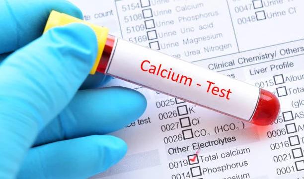 Calcium Test