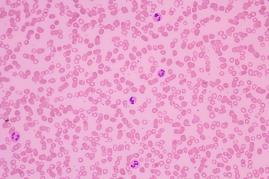 Platelet Count