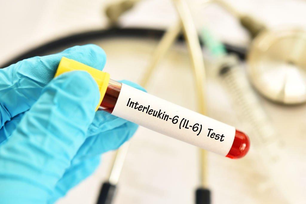 IL 6 Test il-6-test