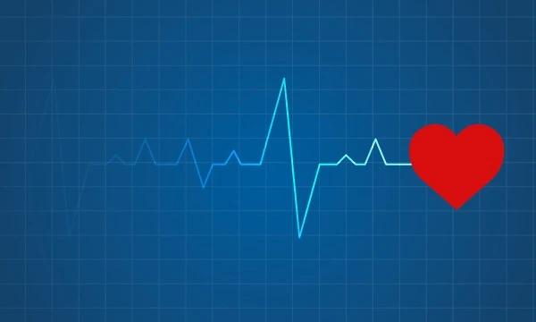 How To Prepare For An ECG?