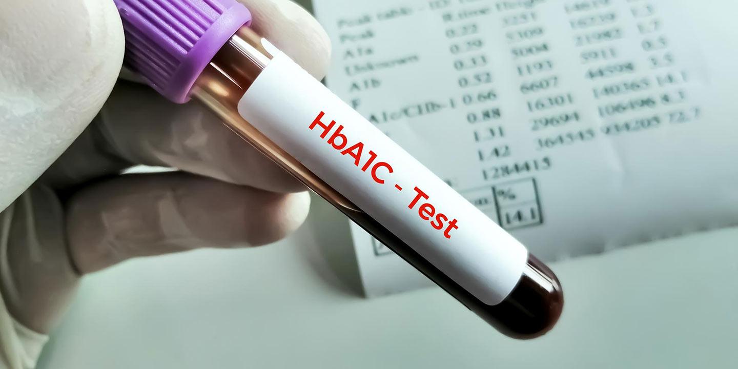 What is A1C(hb1ac) test