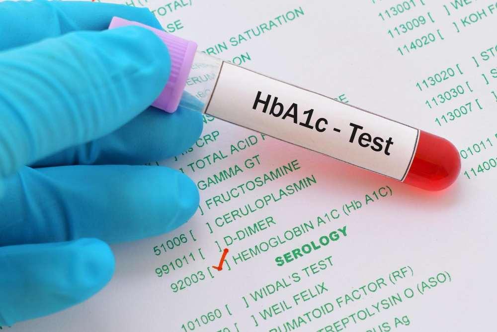 Hba1c test