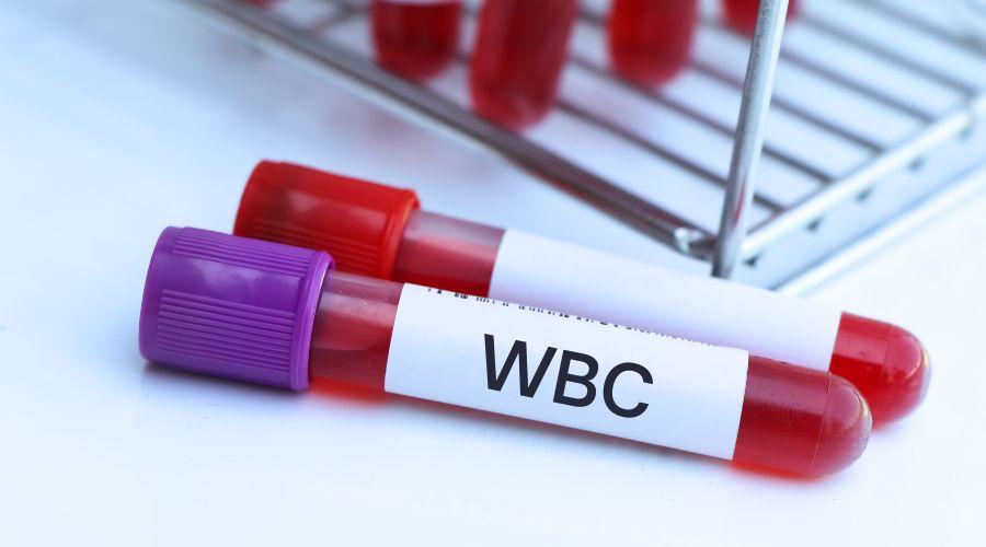 Wbc Rd How to Increase WBC Count? Its Types, Normal Range, & Tips