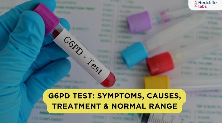 Cbp Lab Test G6PD Test: Symptoms, Causes, Treatment & Normal range
