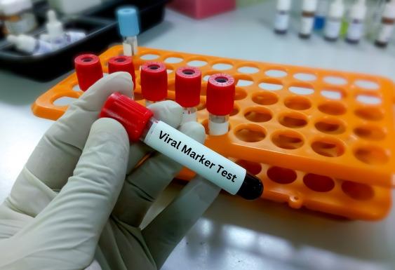 Marker Test Viral Marker Test