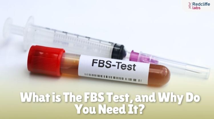 Fbs Rbs Test MyHealth: Expert Health Tips & Insights | Redcliffe Labs