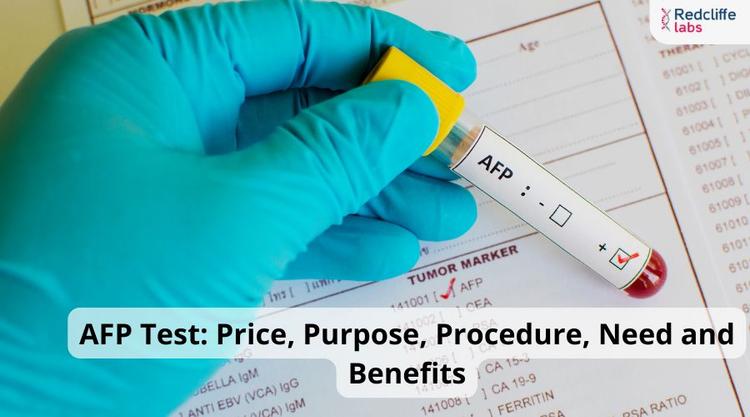 AFP Test: Price, Purpose, Procedure, Need and Benefits