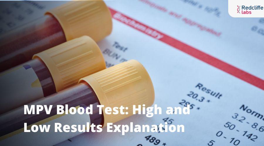 Mp Test Range MPV Blood Test: High and Low Results Explanation