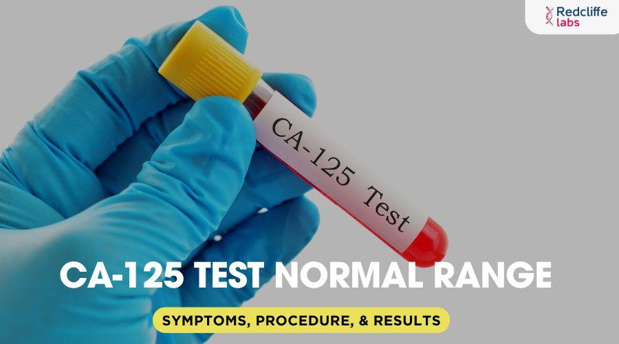 CA125 Test Normal Range Symptoms, Procedure, & Results