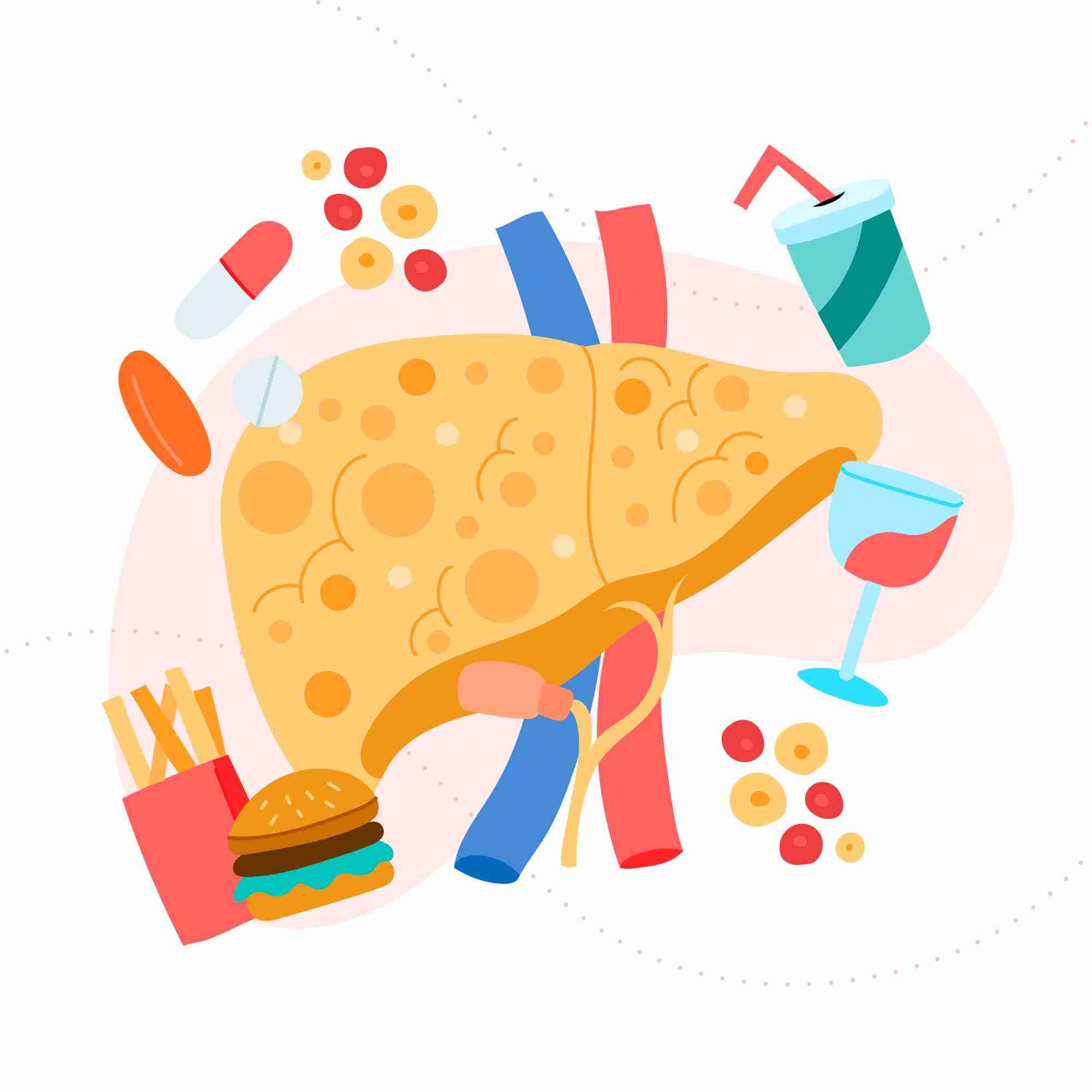 What Is Fatty Liver? Causes, Symptoms, And Treatment?