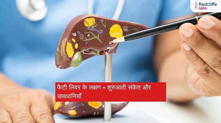 फैटी लिवर के लक्षण - शुरुआती संकेत और सावधानियाँ