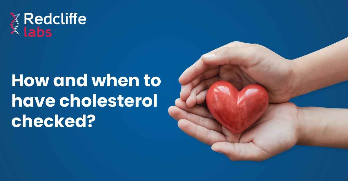 How And When To Have Cholesterol Checked?