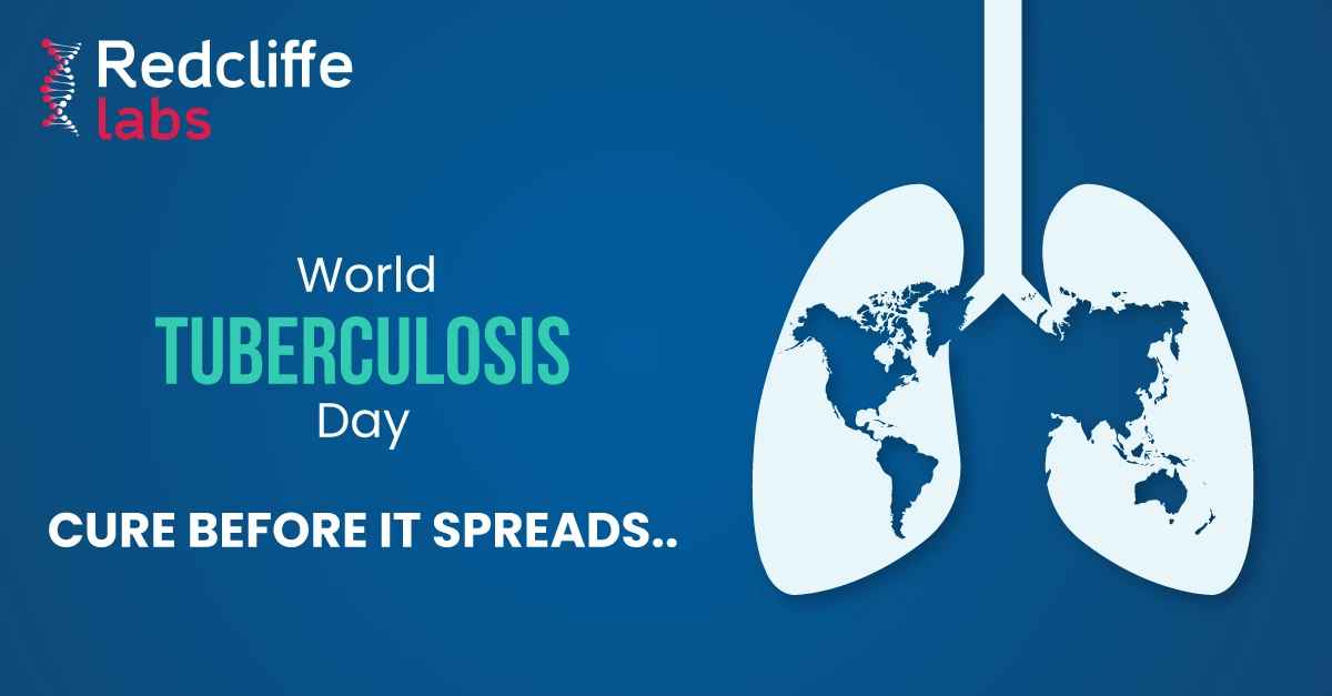 Tuberculosis - A critical health disease