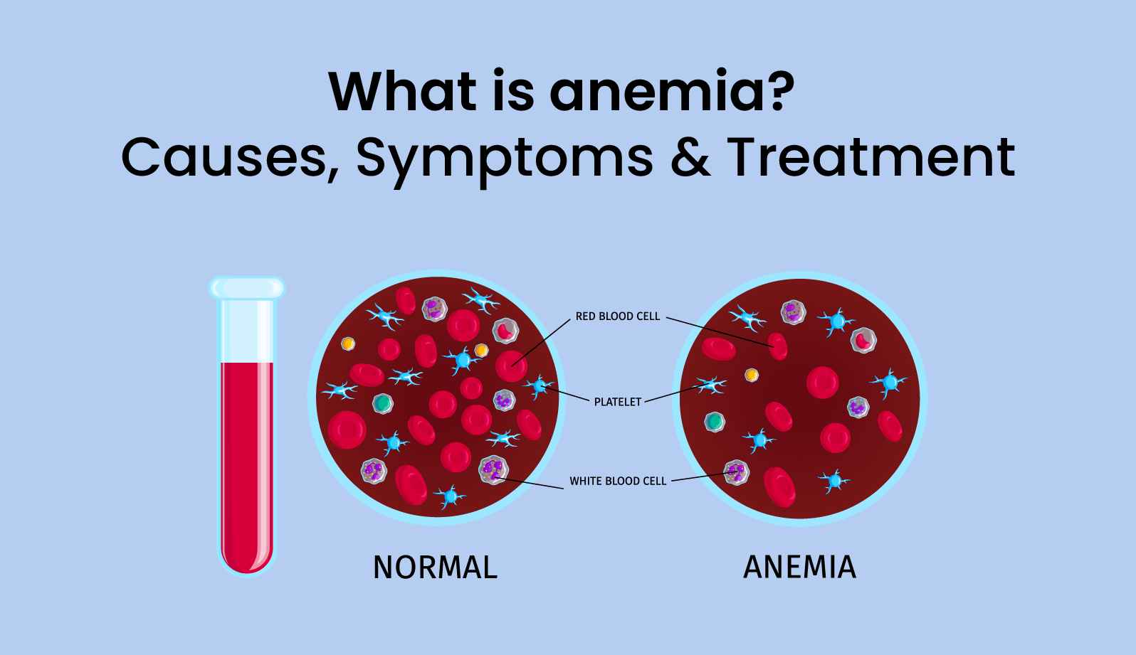 What Is Anemia? Causes, Symptoms & Treatment