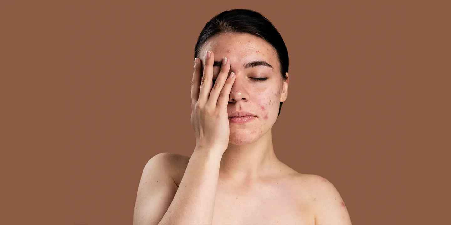 Skin Cancer: causes, symptoms, tests, and treatment