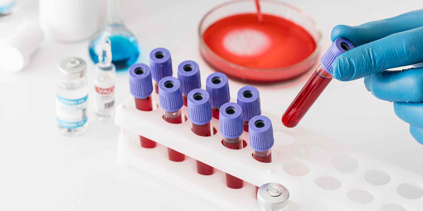 Blood Test That Can Detect Breast Cancer, Available in India Now