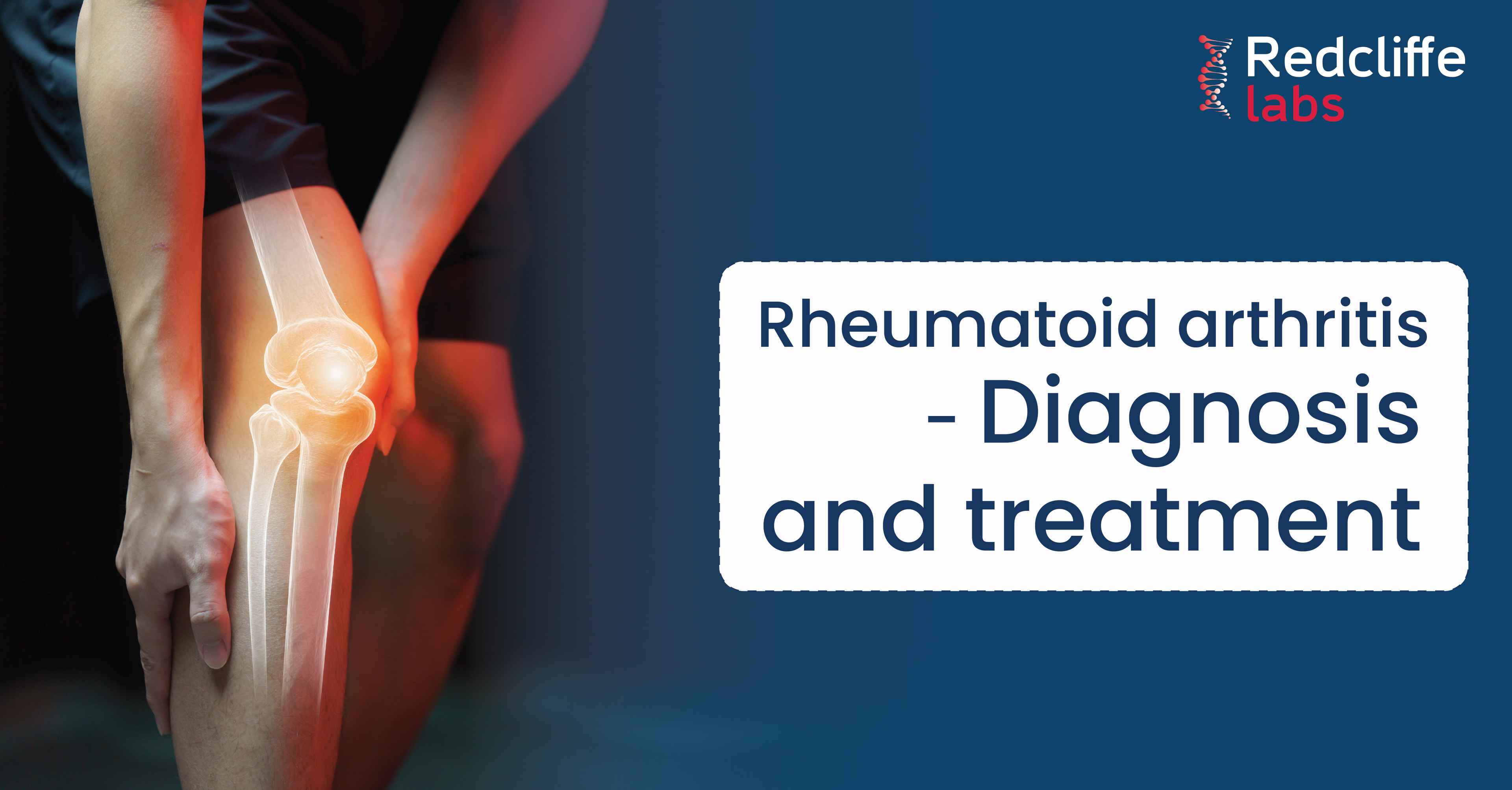 Rheumatoid arthritis - Diagnosis and treatment