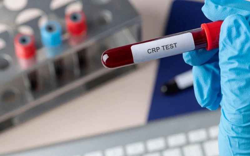 How To Lower Your C Reactive Protein (CRP) Levels?
