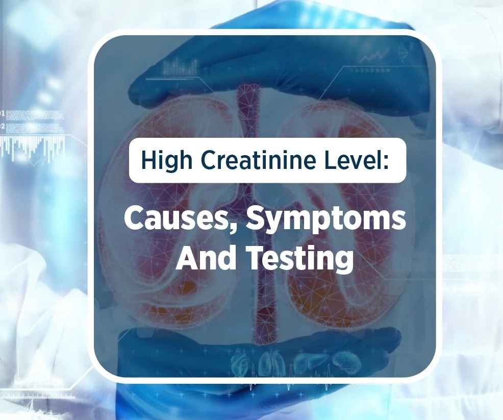 High Creatinine Level: Causes, Symptoms And Testing