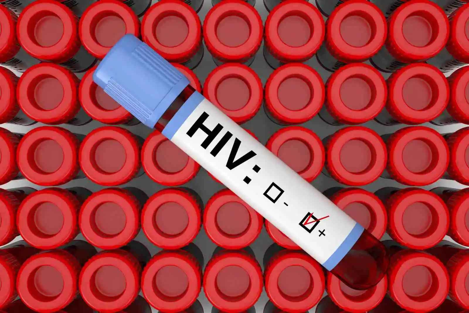 एचआईवी टेस्ट क्या है?(HIV Test in Hindi) संकेत, लक्षण, खर्च और कैसे होता है