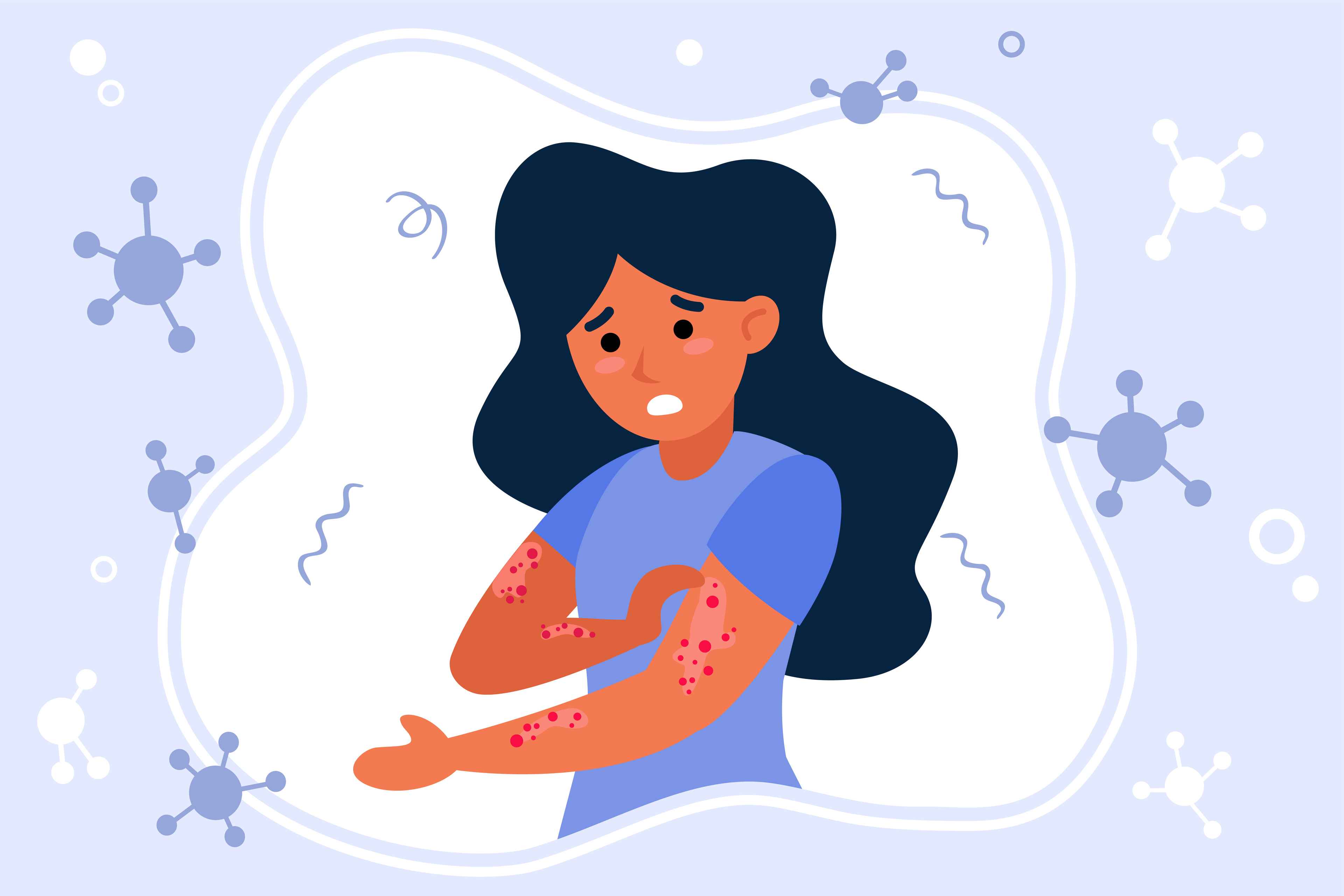 Simple Home Remedies for Fungal Infections