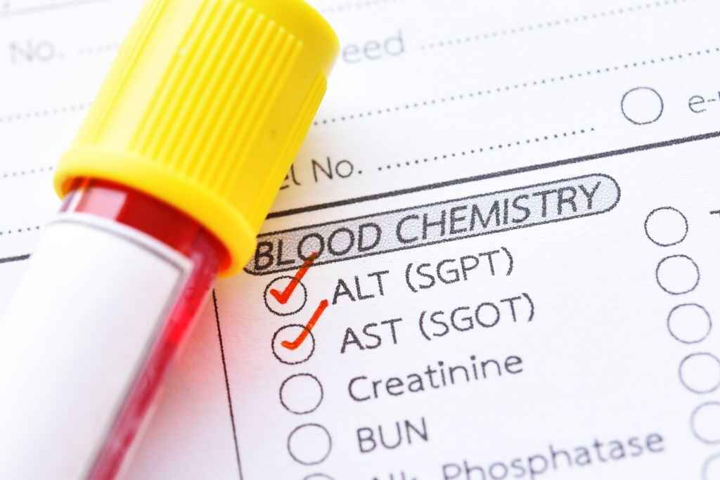 SGPT & SGOT Test: Normal Range, Causes of High Levels & Meaning