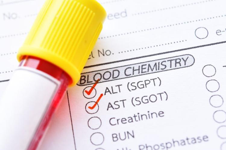 SGPT & SGOT Test: Normal Range, Causes of High Levels & Meaning