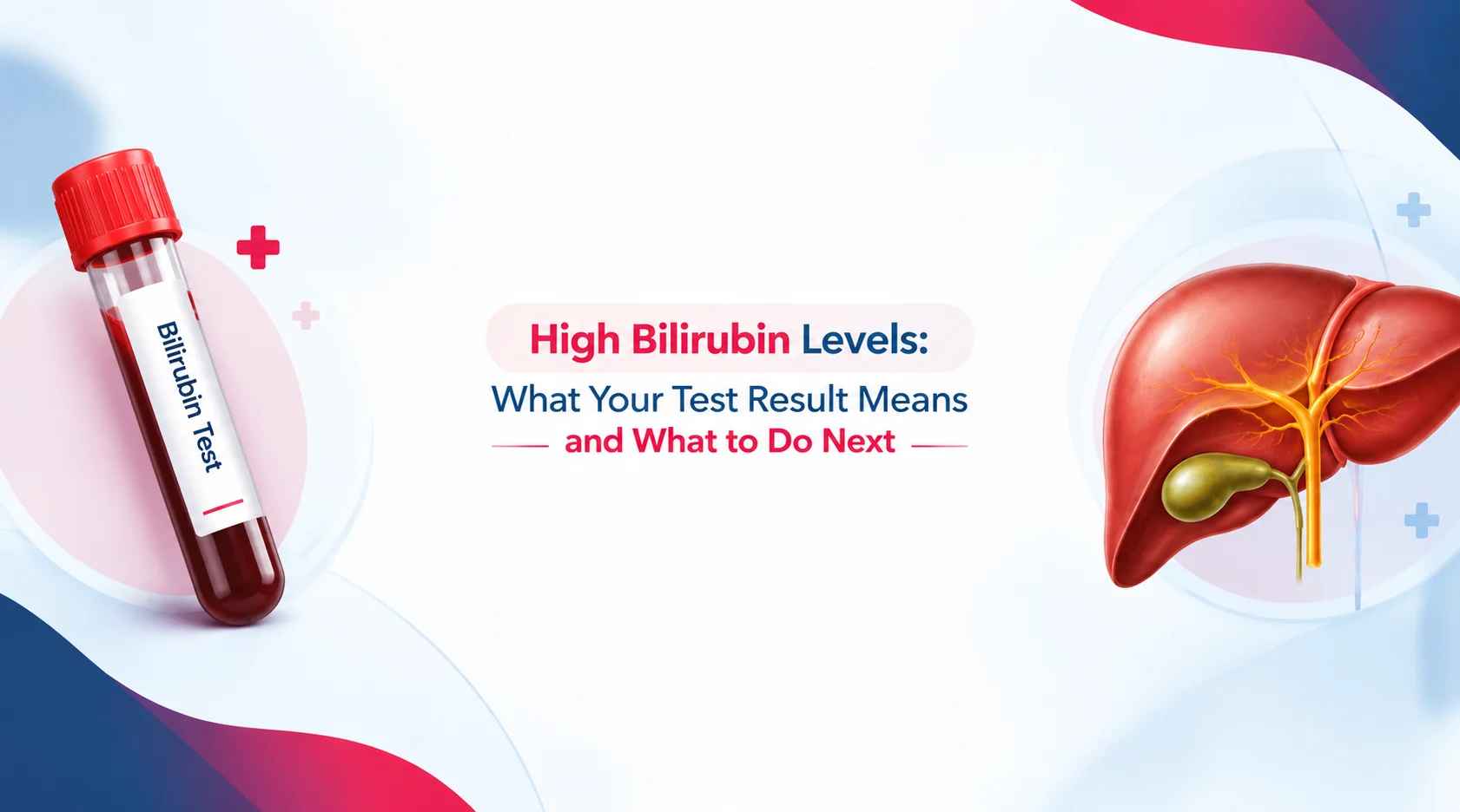 High Bilirubin Levels (Hyperbilirubinemia): Symptoms, Causes, Tests, and Treatments