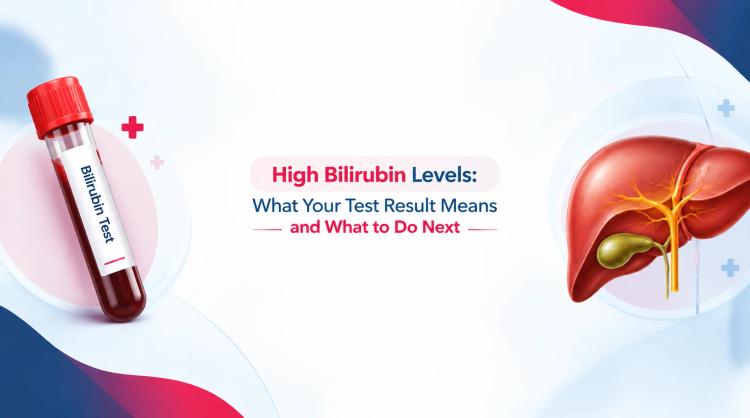 High Bilirubin Levels (Hyperbilirubinemia): Symptoms, Causes, Tests, and Treatments