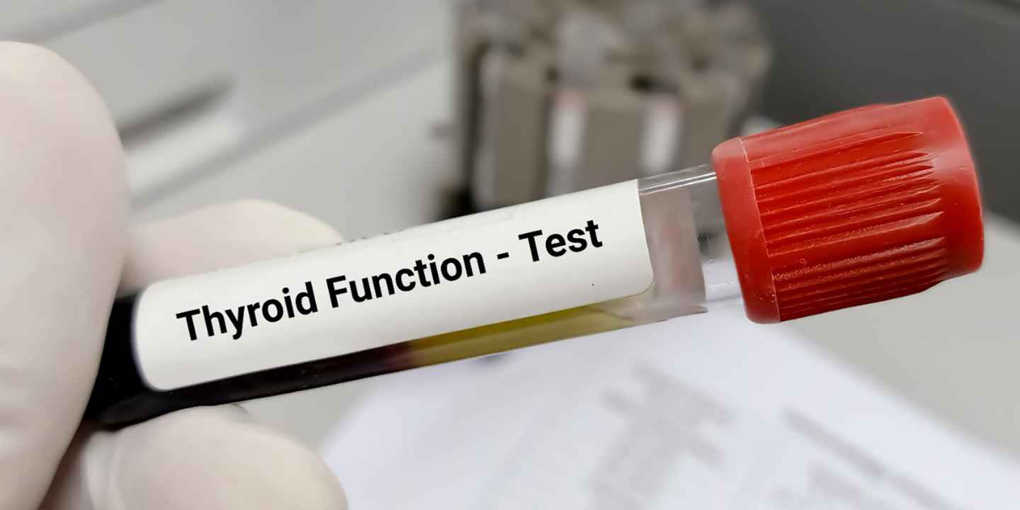 Thyroid Blood Tests - Explained A to Z