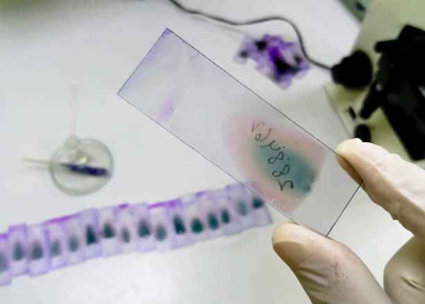 MCV in blood test report: it's full form, meaning and more