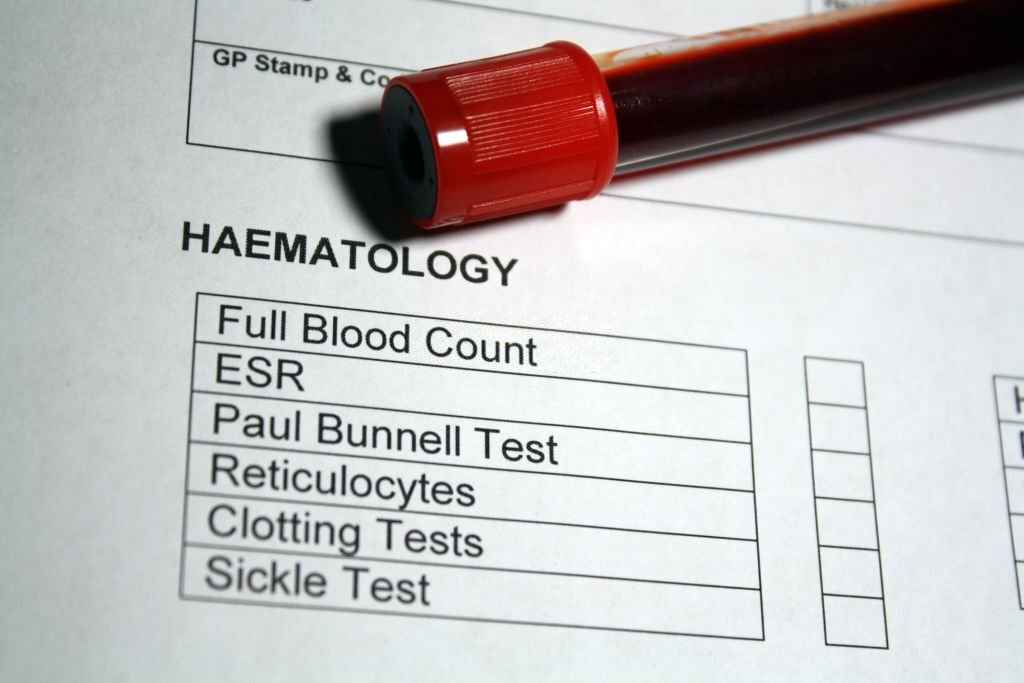 ESR Test: Price, Normal Range in Female, Male, & More