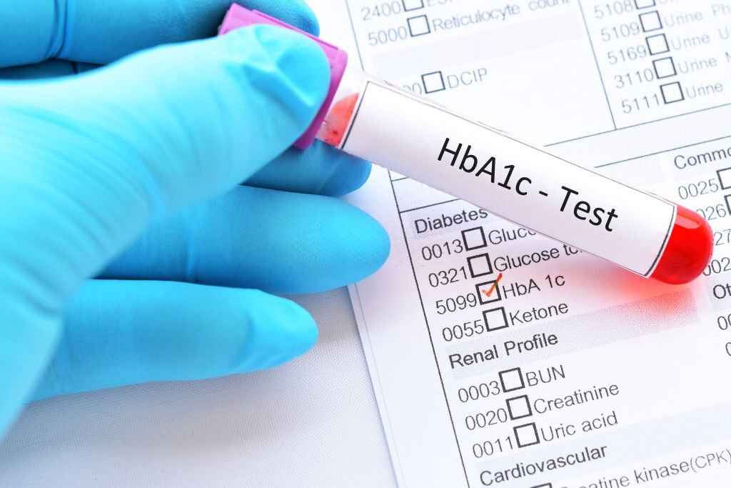 HbA1C Calculator: How to Calculate Estimated Average Glucose Present in Blood