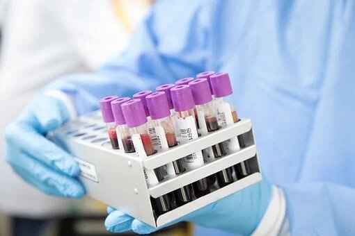 CBC Test: Normal Range, What do Abnormal Levels Indicate?
