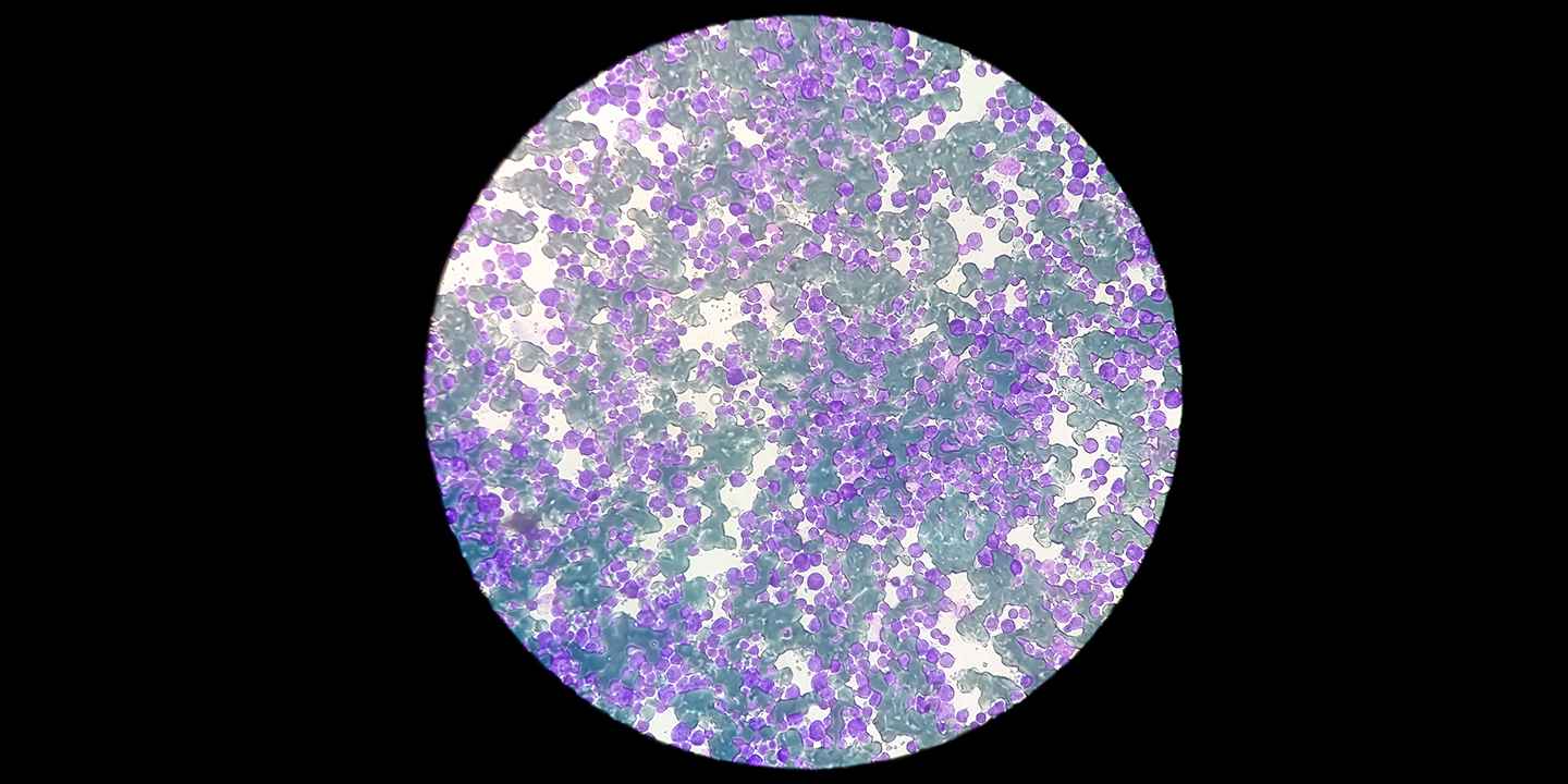 WBC Count: Normal Range How to increase WBC count naturally?
