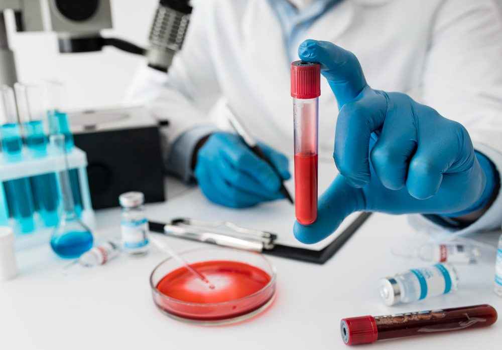 Importance & Significance of Hba1c Test- Diagnosis and Prognosis