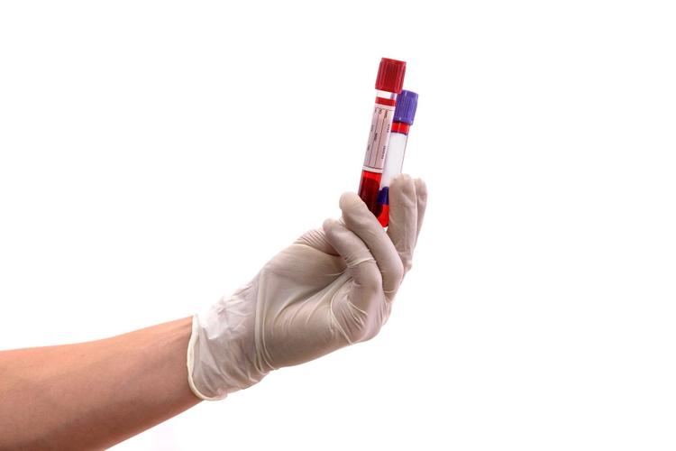 Type of Blood tests for Cold and Cough - Complete Detail