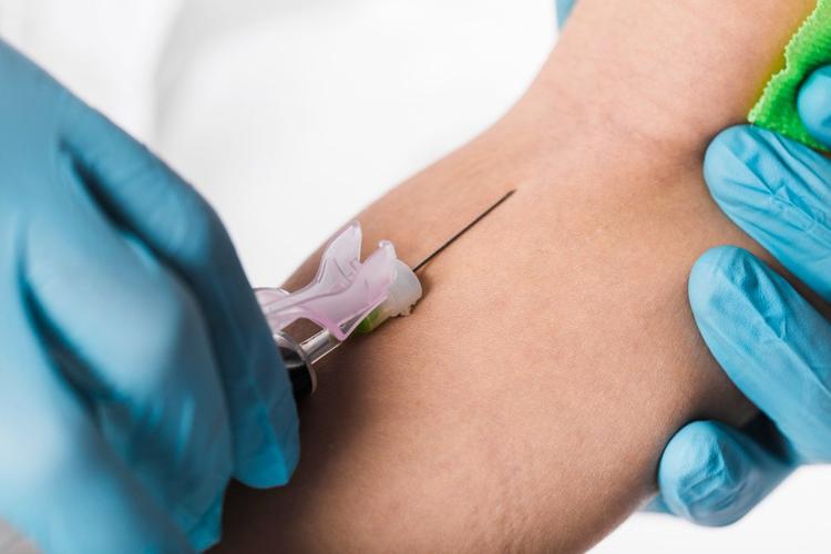 Malaria Test - Price, Range, Preparation, Procedure 2026