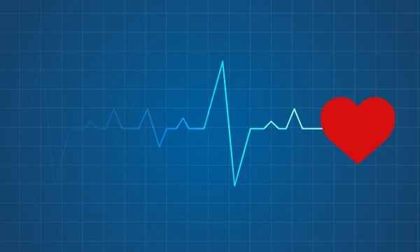 How To Prepare For An ECG?
