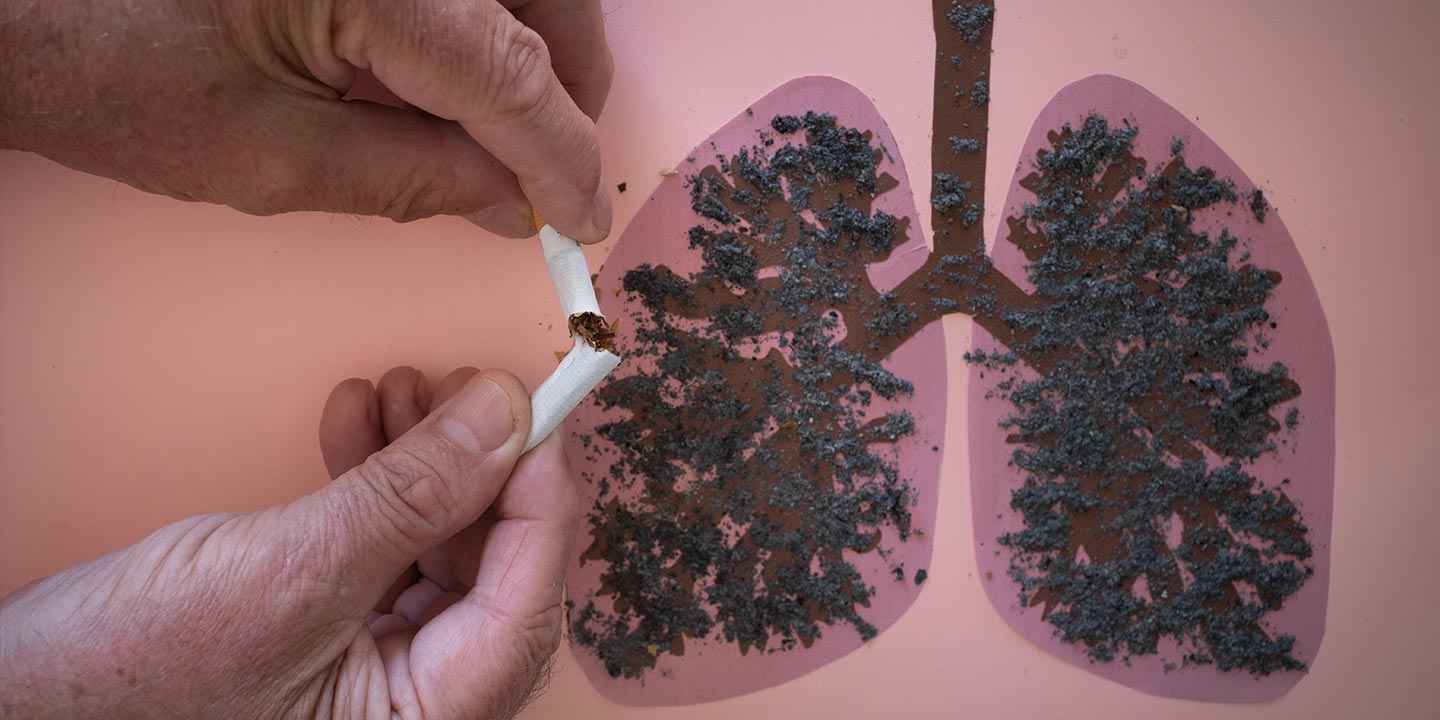 Does Smoking Cause Small Cell Lung Cancer?