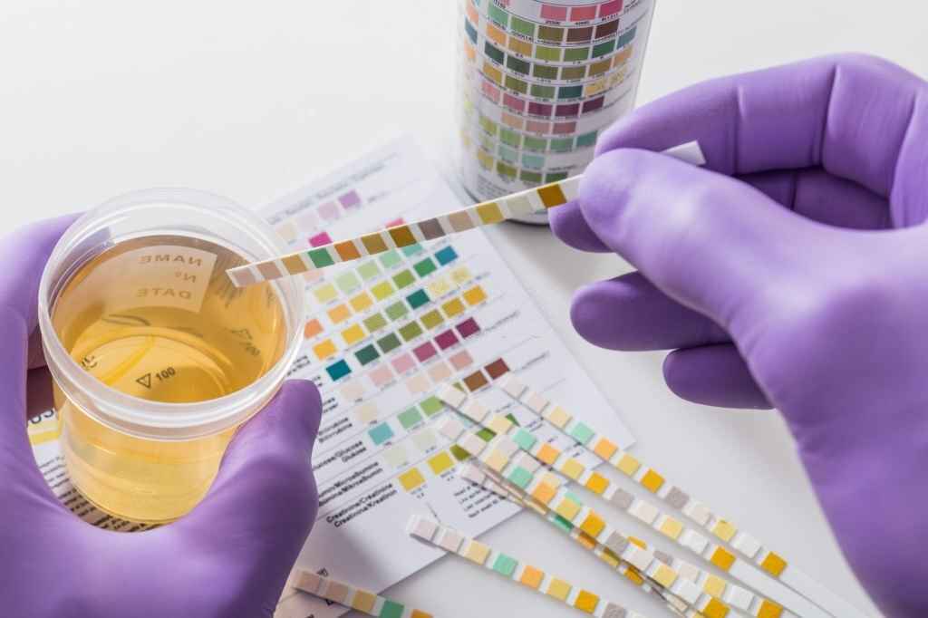 Uric Acid Treatment at Home: How to Control Uric Acid Levels Naturally