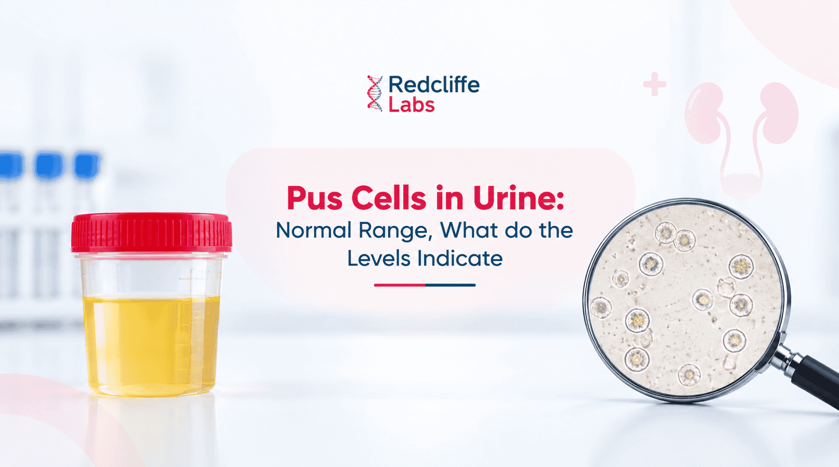 Pus Cells in Urine: Normal Range, What do the Levels Indicate