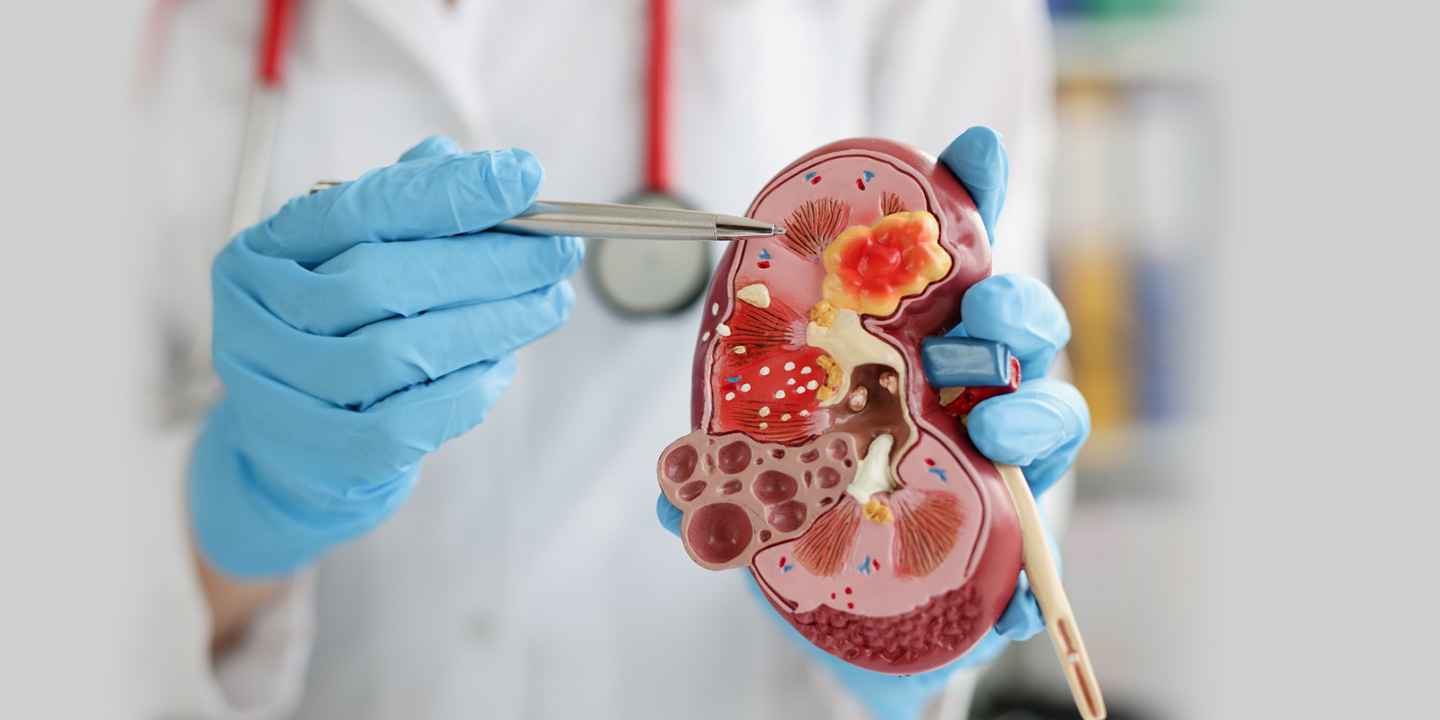Kidney Function, Damage and Abnormalities Tests