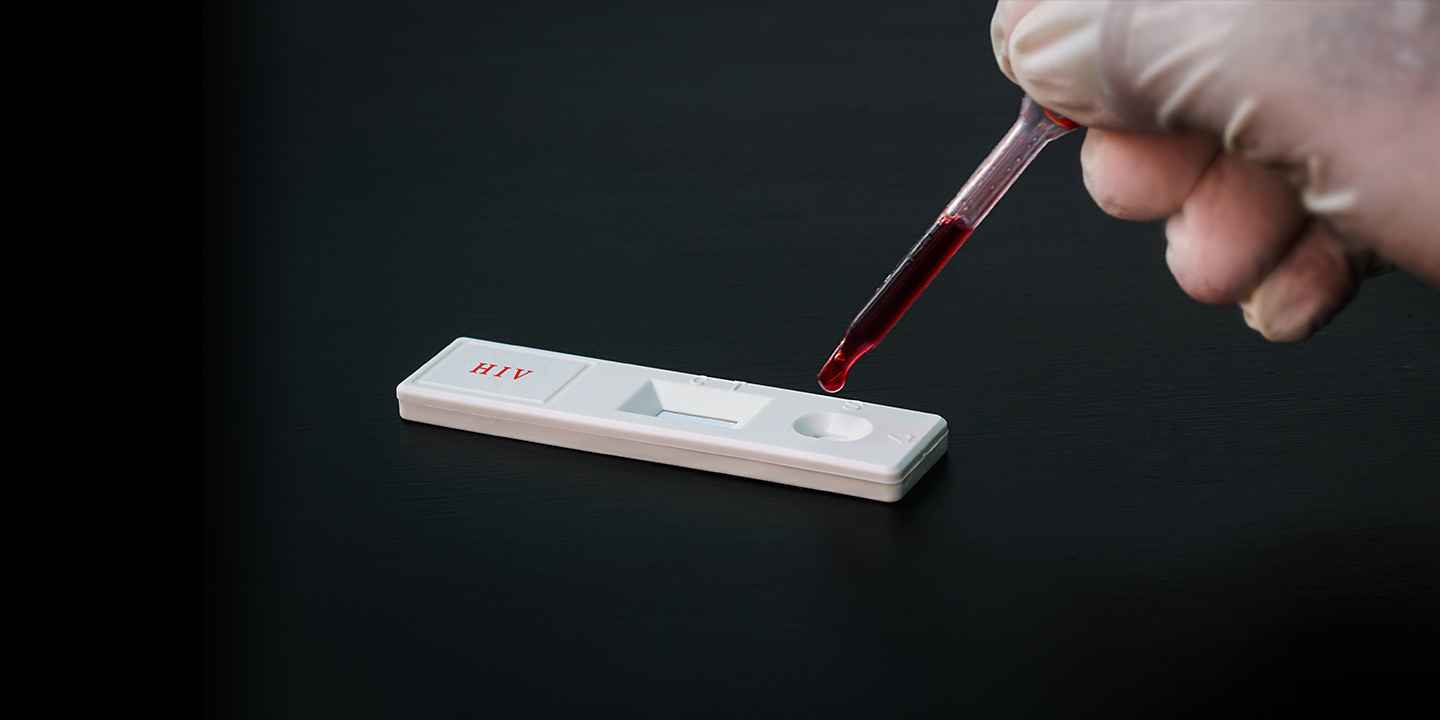 HIV Test Kit: how to test HIV at home, price in india, where to buy online?