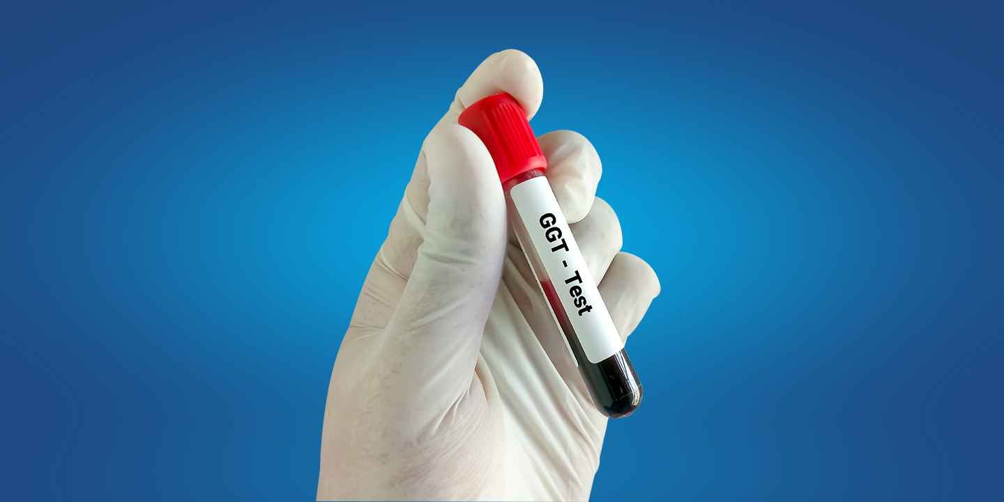 GGT Test: Price, Range, Preparation, Results, & More