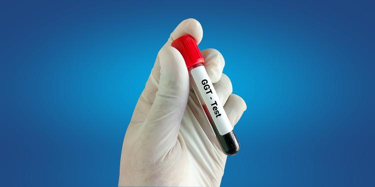 GGT Test: Price, Range, Preparation, Results, & More