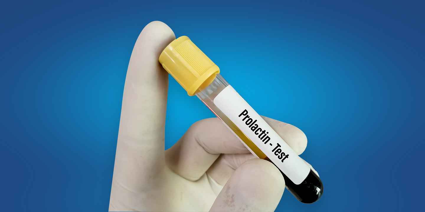 Prolactin Test: Price, Normal Range, High & Low Levels, Need