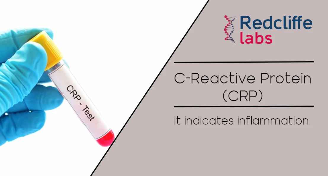 C-Reactive Protein (CRP) Test: Price, Purpose, Range & Results